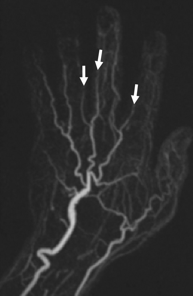 Figure 4b: