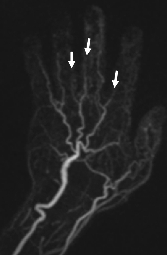 Figure 4a: