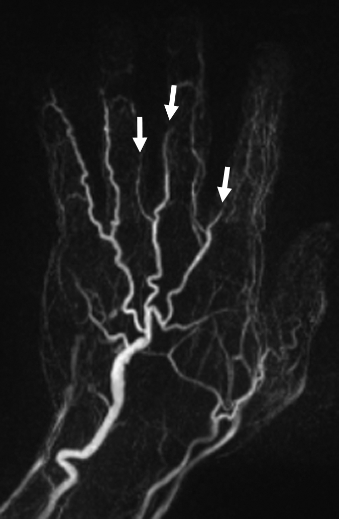 Figure 4c: