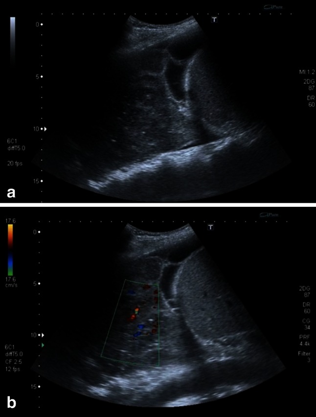 Fig. 11