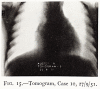 T122-1