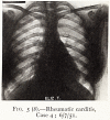 T114-1