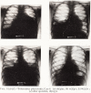 T122-1