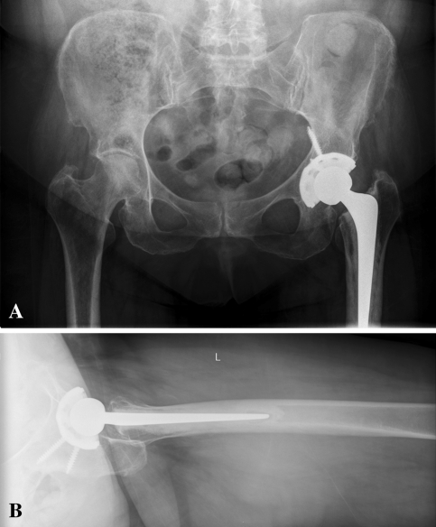 Fig. 3A–B