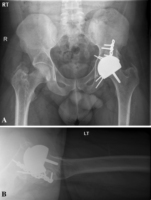 Fig. 2A–B