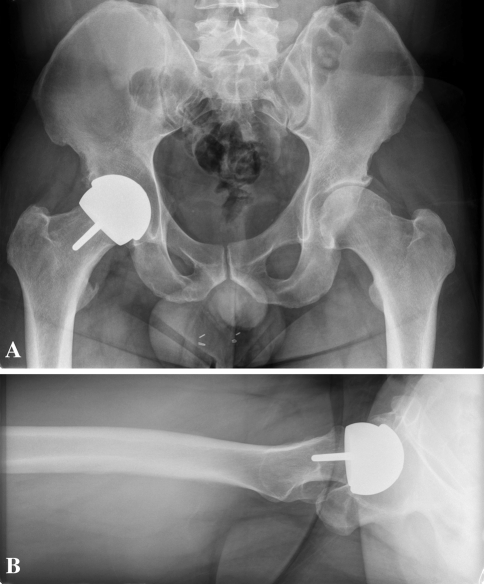 Fig. 1A–B