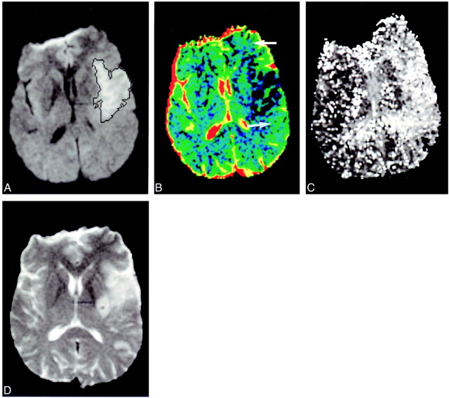 fig 4.