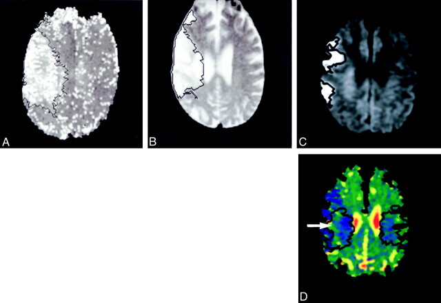 fig 1.