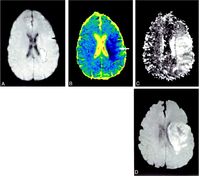 fig 3.