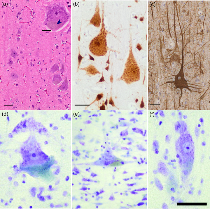 Betz cells of the primary motor cortex - PMC