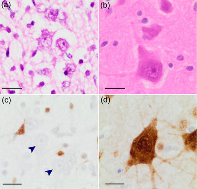 Betz cells of the primary motor cortex - PMC