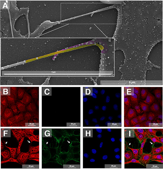 FIG 6