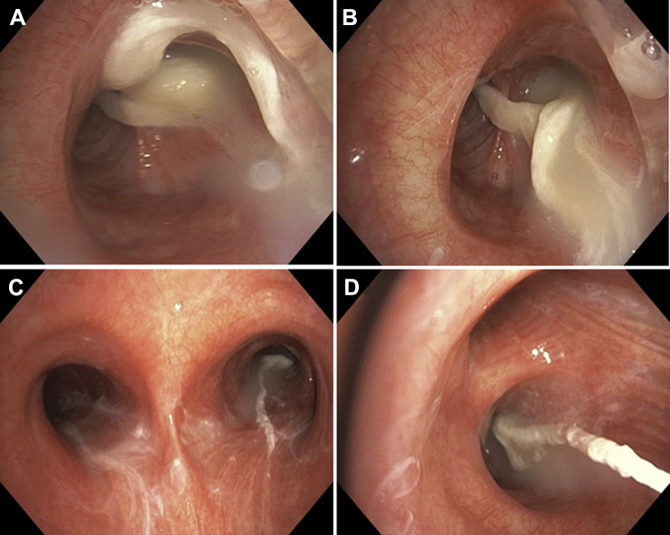 Figure 20