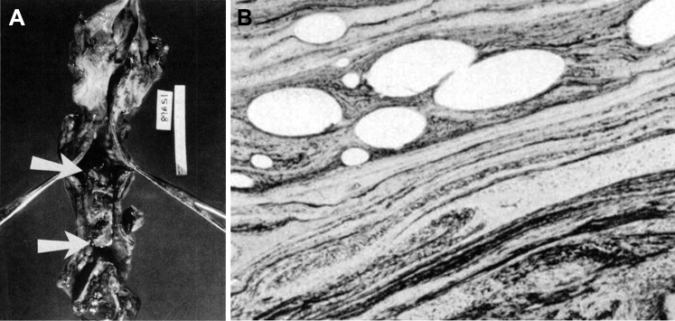 Figure 22