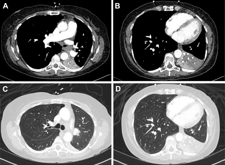 Figure 13