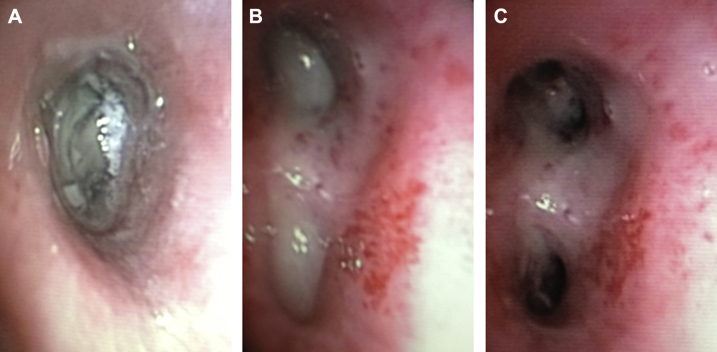 Figure 24