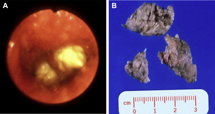 Figure 19