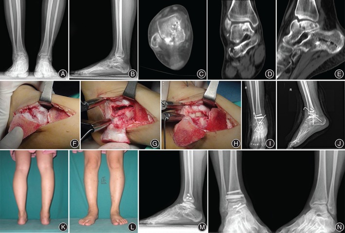 Figure 2