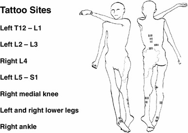 Fig. 1