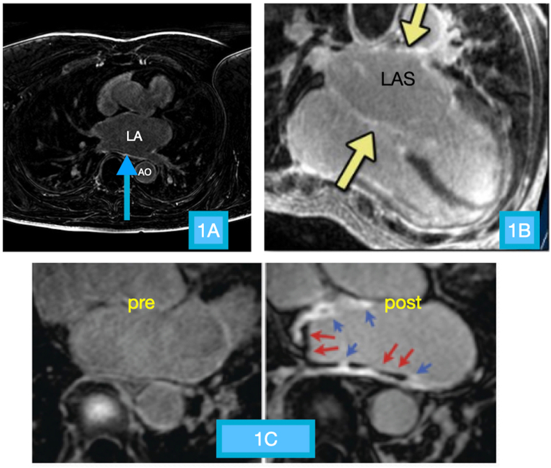 Fig. 1