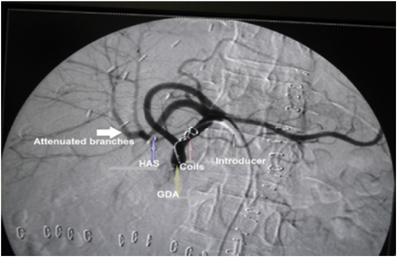 Fig. 6