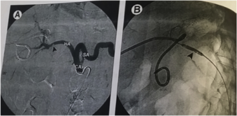 Fig. 7