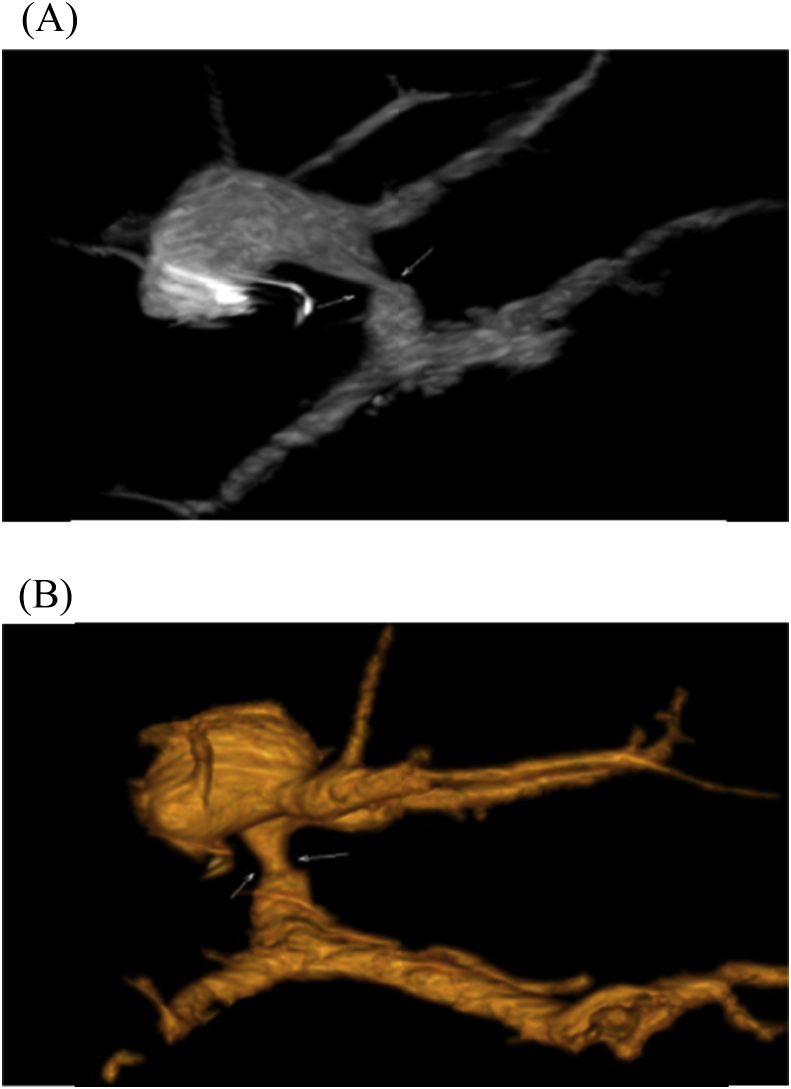 Fig. 12