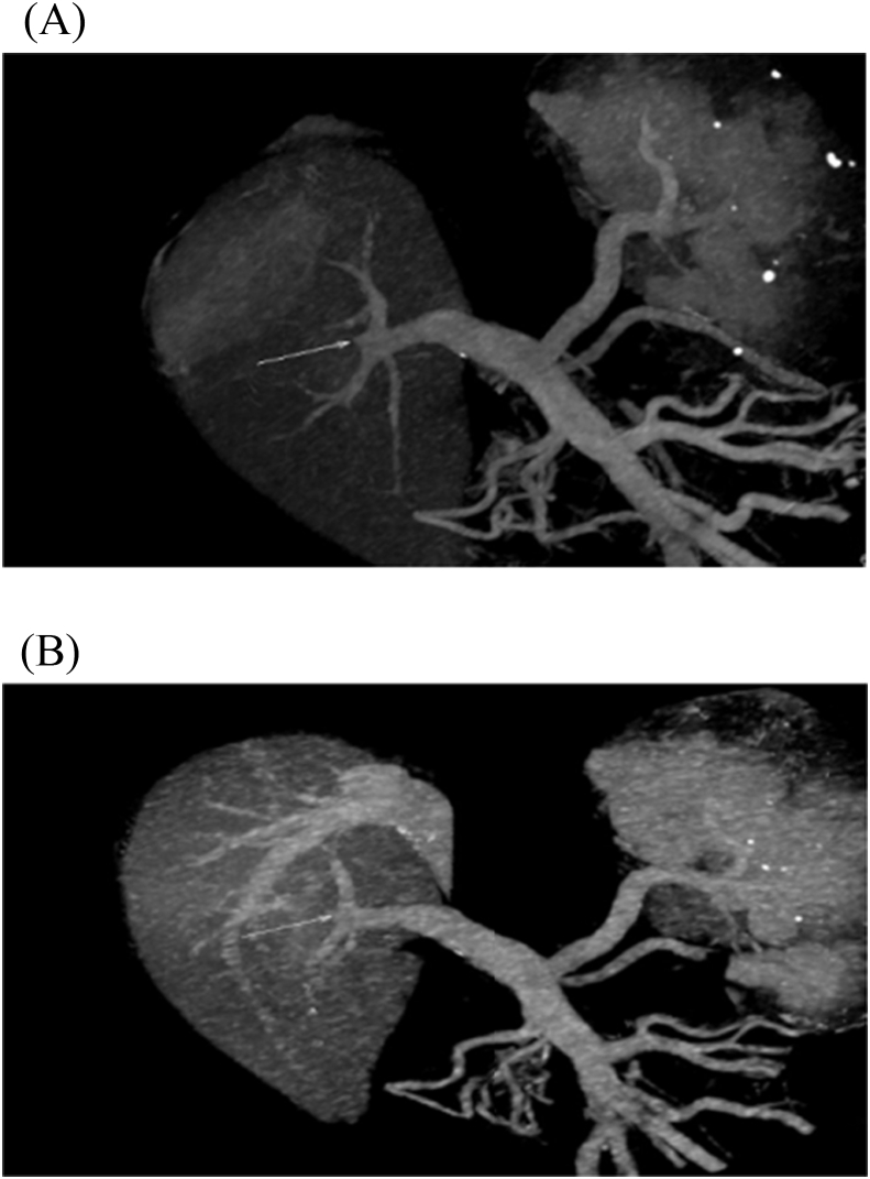 Fig. 13