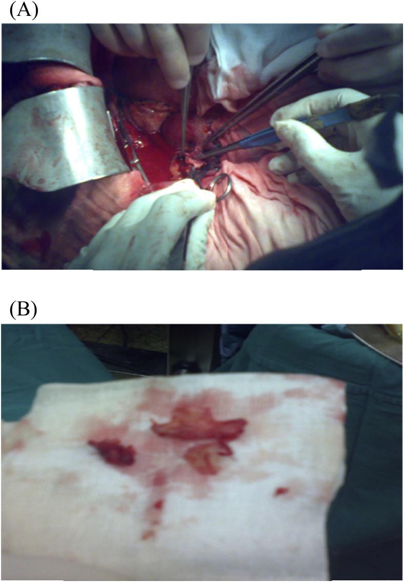 Fig. 2