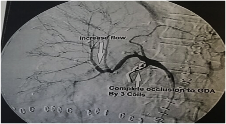 Fig. 11