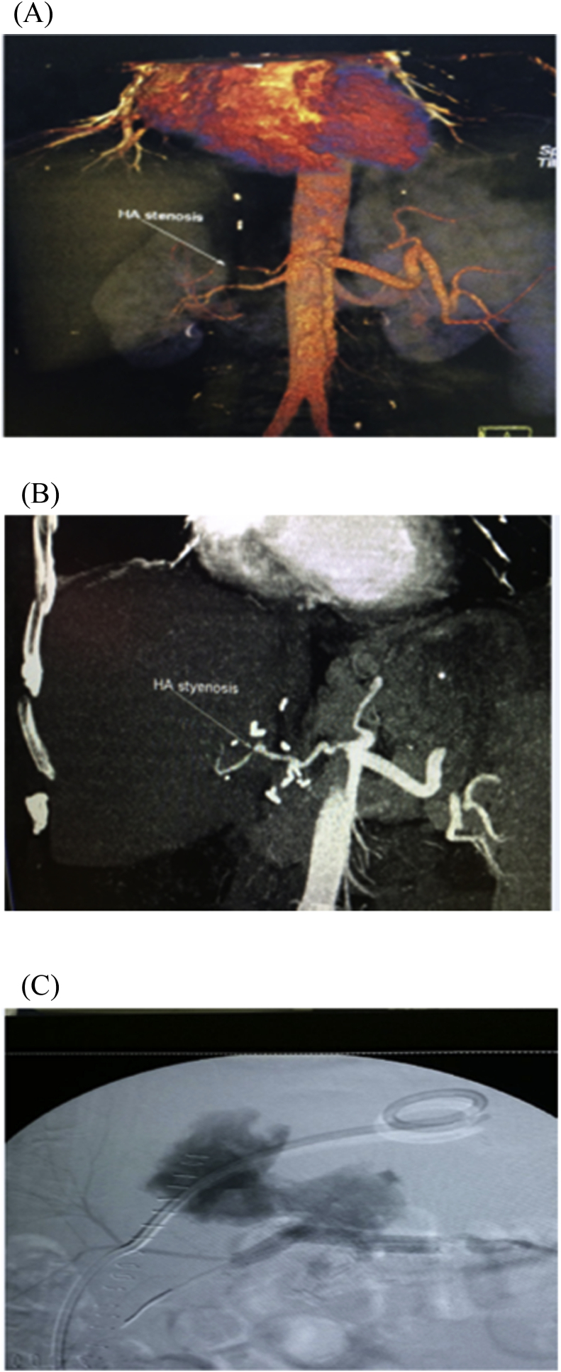 Fig. 10