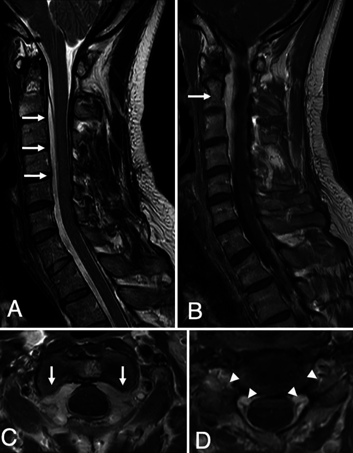 FIG. 2.