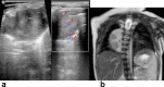 Figure 11.