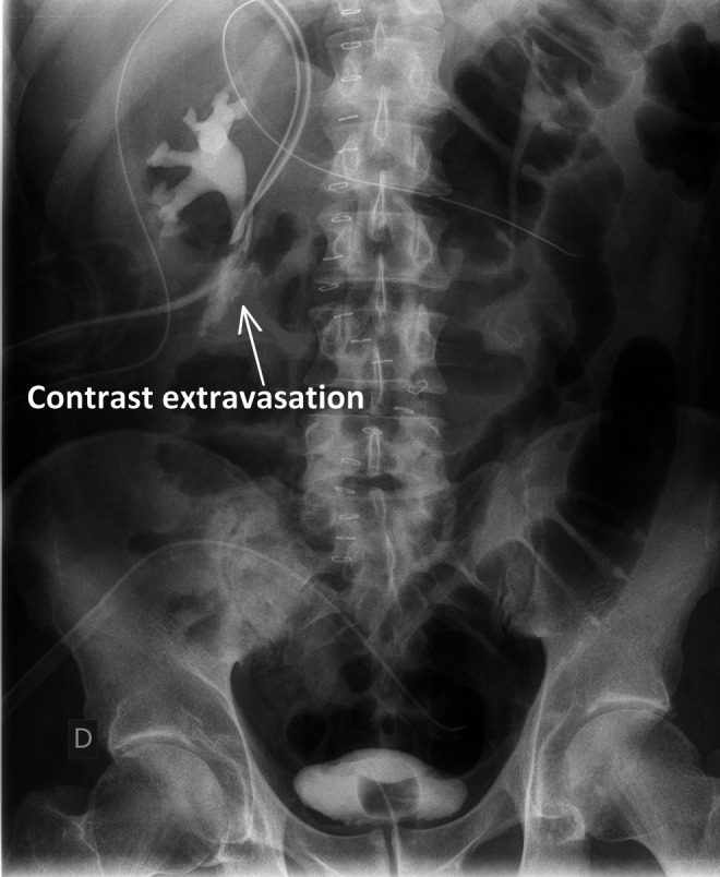 FIG. 1.