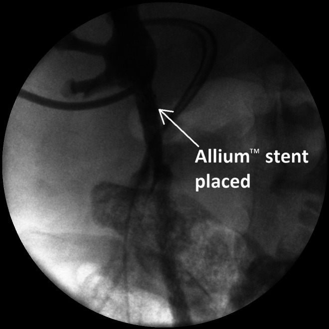 FIG. 2.