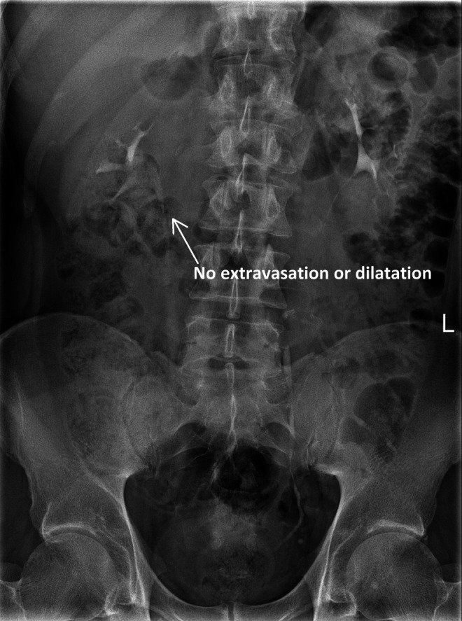 FIG. 3.