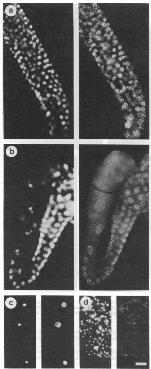 graphic file with name pnas00444-0197-a.jpg