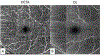Figure 11.