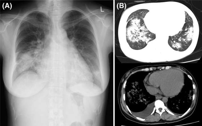 FIGURE 1