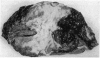328