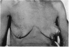 325