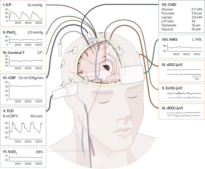 FIGURE 1