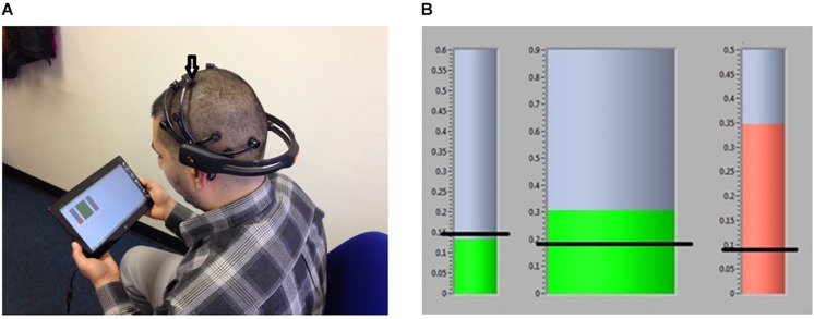 FIGURE 2