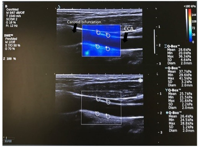 Fig. 1