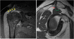 Fig. 28