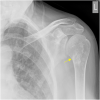 Fig. 12