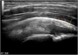 Fig. 20