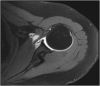 Fig. 27