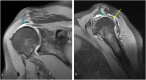 Fig. 31