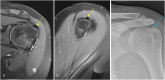 Fig. 33